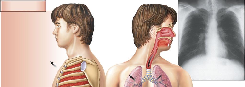 11/23/2014 The tube connecting the larynx to the primary bronchi is Common passageway for air, food and drink Conducts air from the to the bronchioles 3. bronchioles 4. 3. bronchioles 4. 3. bronchus 4.