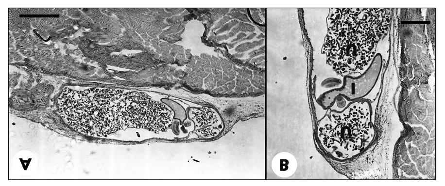 Fig. 3. Philometroides africanus sp. n., histological section through gravid female embedded in the host s skin. H&E.