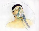 Notes on BIPAP/CPAP M.