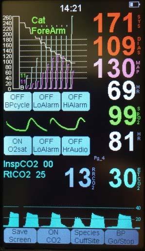 4) When the warm up is complete, the petmap+ii display will look like this if Pg_4 is selected, displaying the capnograph, ETCO2 value and RRCO2 (Respiration