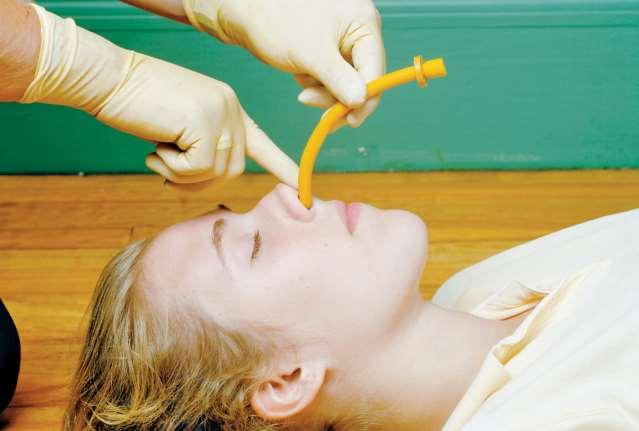 Inserting NPA Gently push the tip of the nose upward, and insert the airway with the beveled side toward the base of the nostril