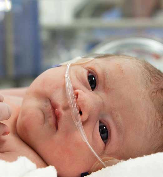 Regional Lung Ventilation in Infants. Judith C Weinknecht. June 2009 PhD Dissertation 2. Continuous Noninvasive Monitoring of Tidal Volumes by Measurement of Tidal Impedance in Neonatal Piglets.