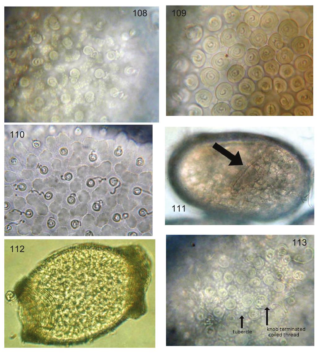 Canadian Journal of Arthropod Identification No.7 (October 2008) Figs. 108-113: eggs.