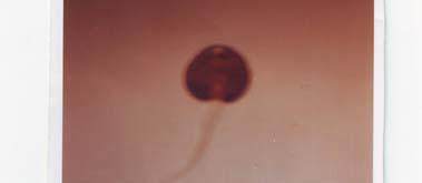 (2002) also stated that the distribution of schistosomiasis is focal and restricted to areas with peculiar ecological characteristics which favor snail breeding, water contact, and intensive