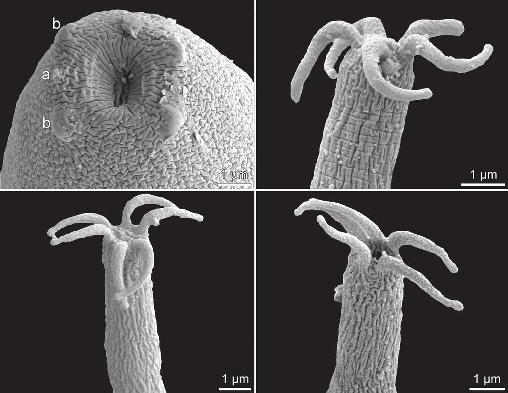 A B C D Fig. 8. Procamallanus (Spirocamallanus) pseudospiralis sp. n. from Synodontis schall (Bloch et Schneider), scanning electron micrographs of first-stage larva from uterus.