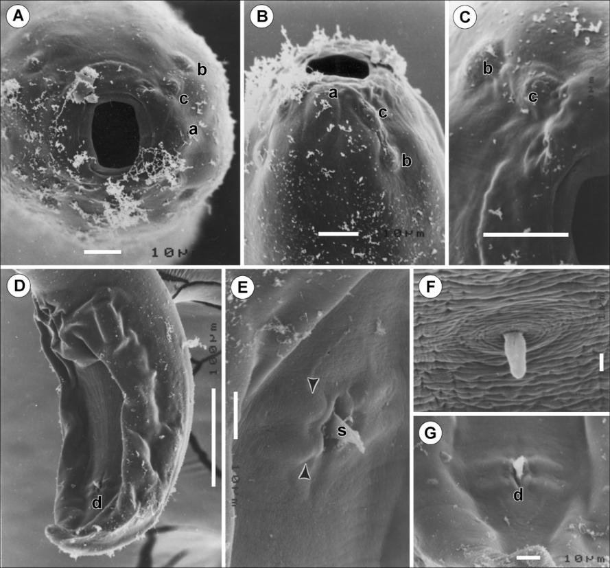 Fig. 5. Procamallanus (Spirocamallanus) variolae sp. n., scanning electron micrographs of male from Variola albimarginata.