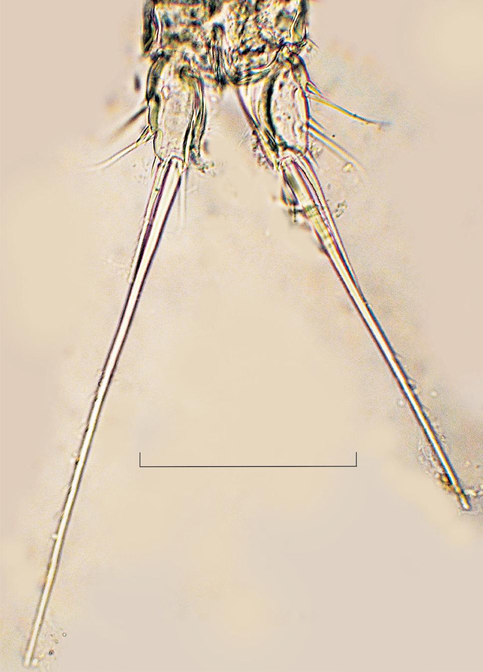 Genus Elaphoidella Chappuis, 1929 Elaphoidella bidens (Schmeil, 1893) (Fig. 3a k) Fig. 2. Attheyella (Chappuisiella) prope inopinata, male caudal rami, photo. Scale bar: 0.1 mm. (Fig. 1c).