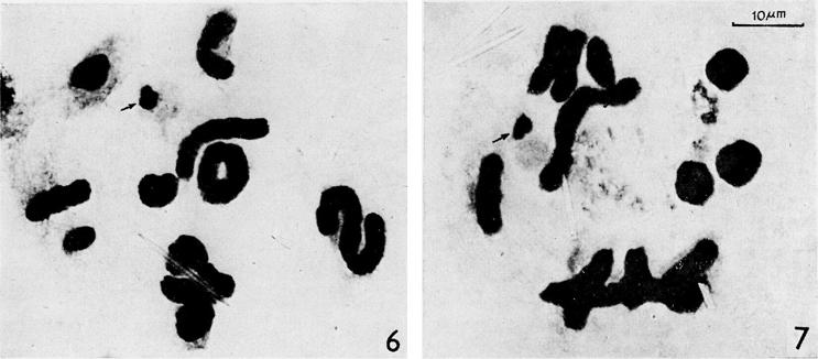 330 LALITHAMB!KA BAI and KURIACHAN morphology. In some cells it is very much contracted to form a short segment stainable with acetocarmine, at the distal end of the chromosome arm (Fig.