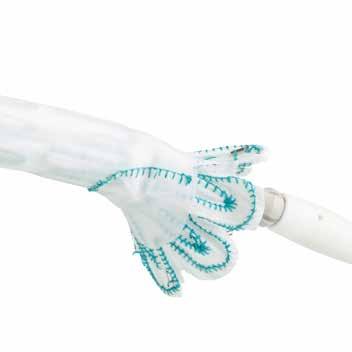INNER SHEATH Flexible inner sheath allows for atraumatic advancement and staged graft expansion for better control.