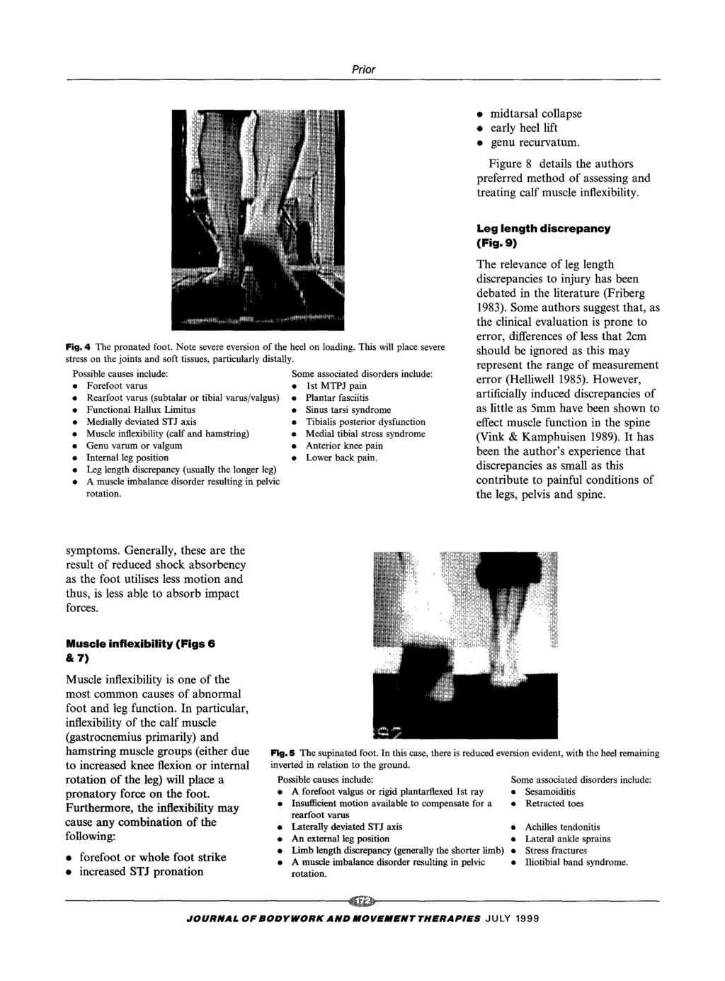 Prior midtarsal collapse early heel lift genu recurvatum. Figure 8 details the authors preferred method of assessing and treating calf muscle inflexibility. Leg length discrepancy (Fig.