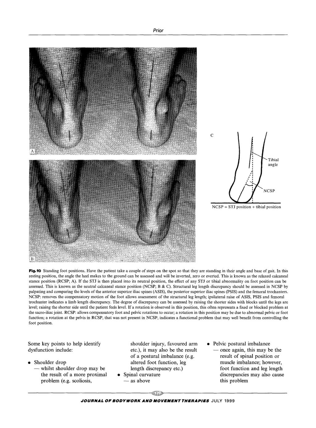 - - once Prior i "" Tibial angle,( NCSP = STJ NCSP i ~osition + tibial position Fig.lO Standing foot positions.