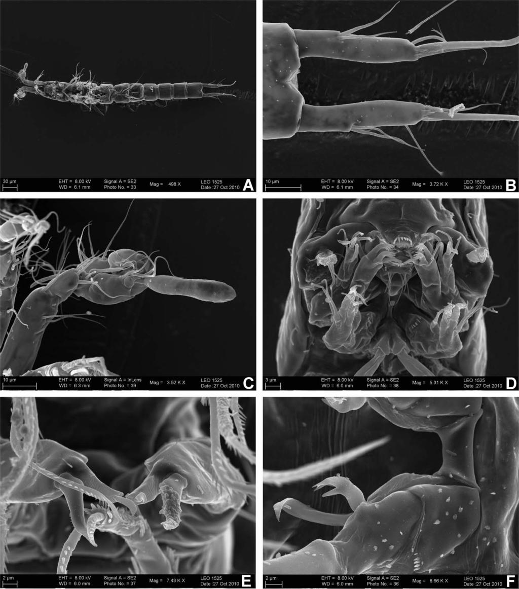 1592 T. Karanovic et al. Figure 7. Proserpinicaris wangpi sp. nov., scanning electron micrographs, holotype male.