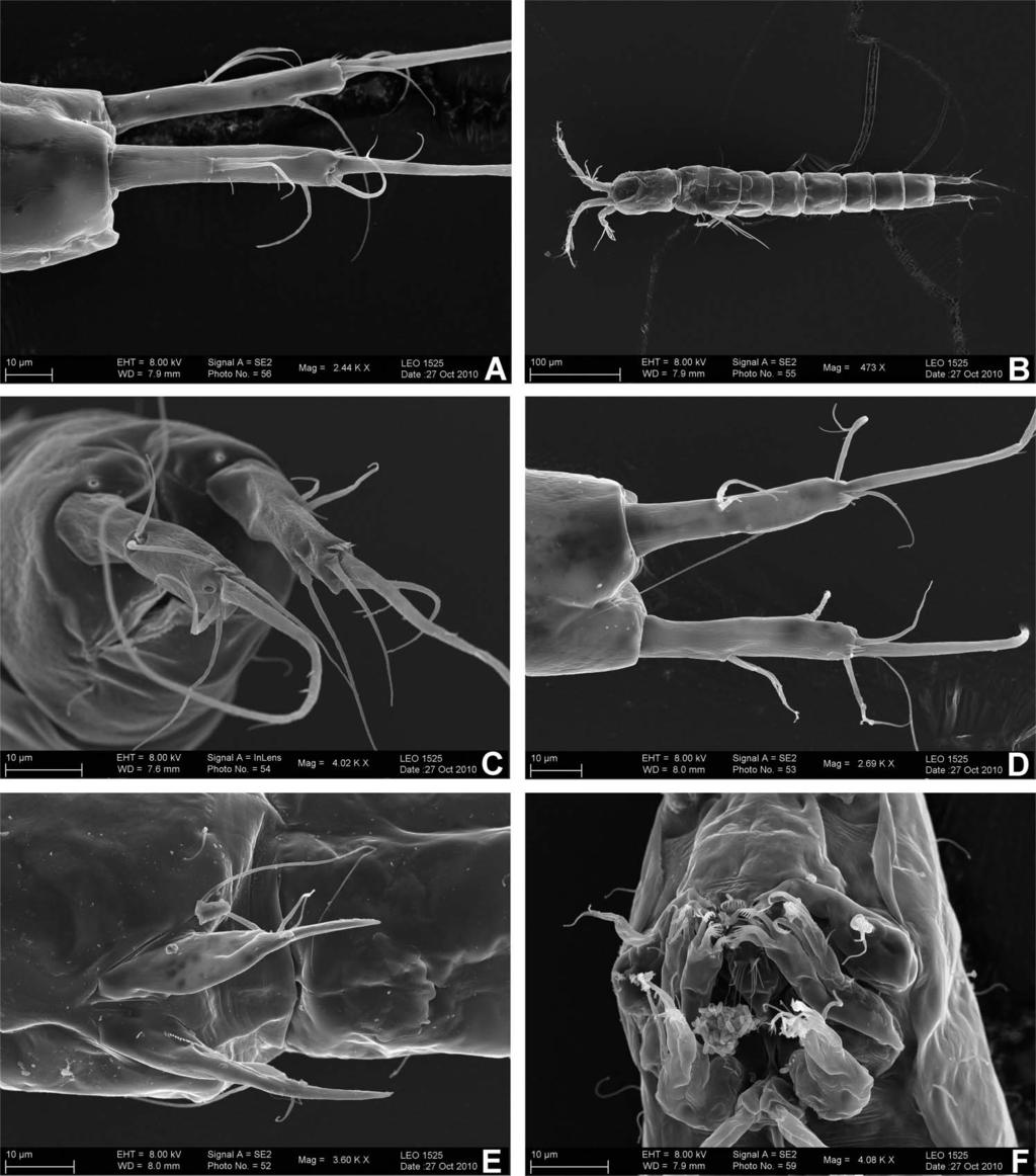 Journal of Natural History 1581 Figure 2. Proserpinicaris young sp. nov., scanning electron micrographs, (A) paratype male 2; (B) paratype female 1; (C) paratype female 2; (D F) allotype female.