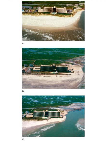 Barrier Islands Bertha 7/16/1996 Fran 9/7/1996 After the passage of three hurricanes in a two year time span, this hotel
