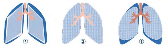 5.1 Monitoring patient data using the dynamic lung The dynamic lung shows compliance