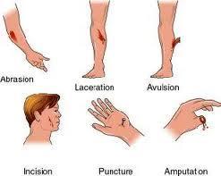 Types of open wounds Abrasions
