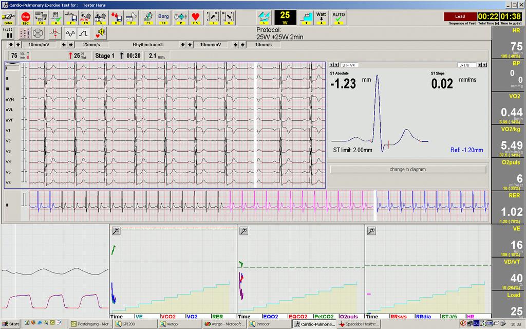 5 Software Overview The procedure is part of the cardiopulmonary exercise test software.