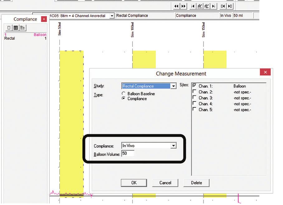 Click and drag a box around the compliance boxes to magnify both x and y axes.