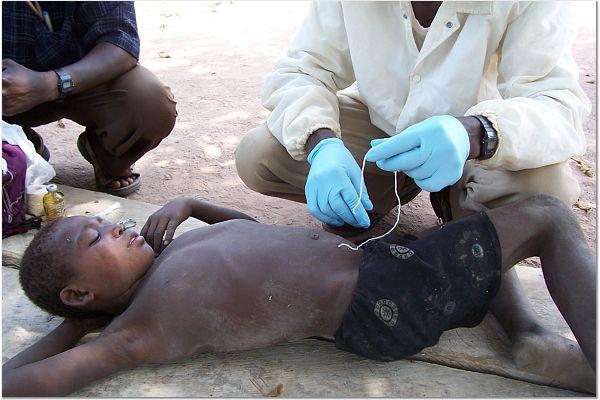Overview of the Dracunculiasis (Guinea Worm Eradication) Program Ernesto
