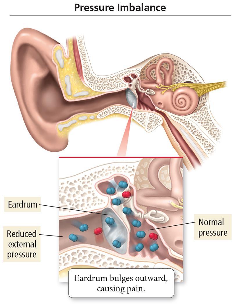Pressure Imbalance in the Ear If there is a difference in pressure across the