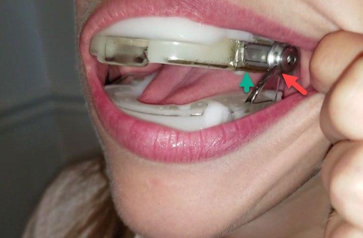 r if If the wing is in the position of the Green arrow or the Red arrow, then the mouth will not close.