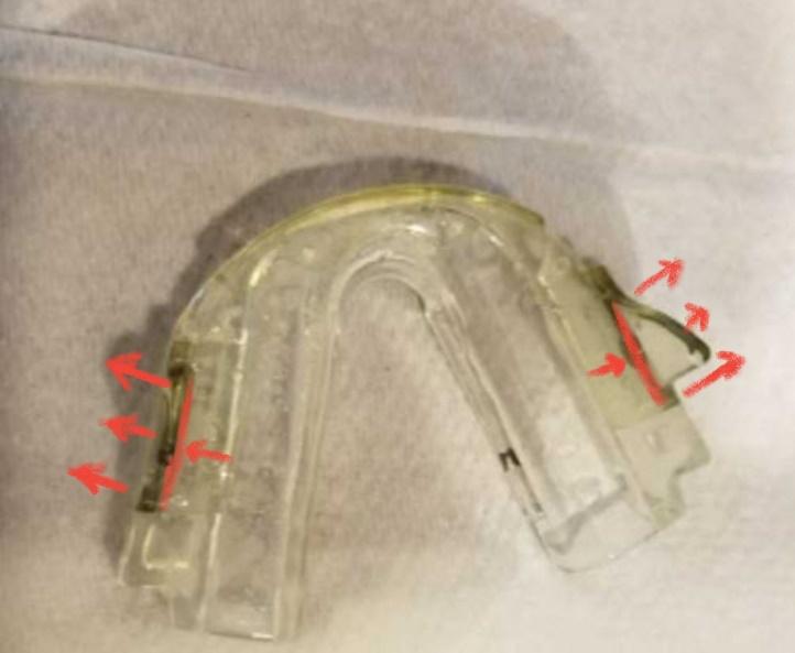 See below: 4 Once the lower mouthpiece is softened as in figure 1, grasp the base of the wings with a clamp or thin pliers.