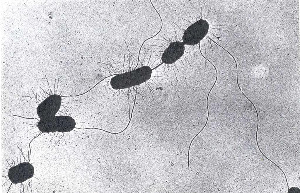 Salmonella bacterium Bacteria Salmonella Vibrio cholera