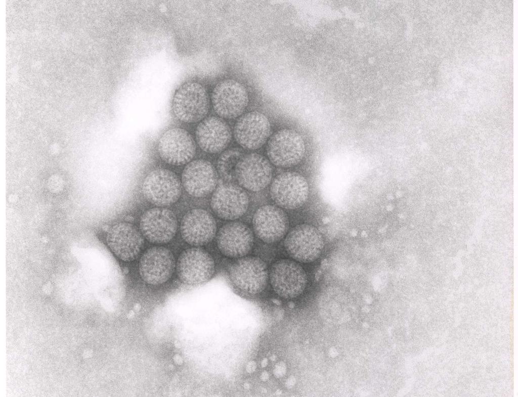 Viruses Hepatitis A Enteroviruses (polio)