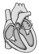 Normal Heart Cardiomyopathy Thickened heart muscle http://www.daviddarling.