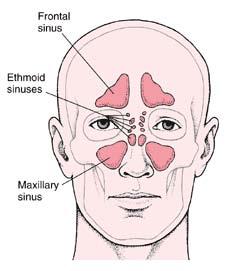 MIDDLE EAR AND SINUS PROBLEMS II - A - 3 EAR BLOCK CONTINUED.