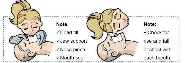 GIVING BREATHS Giving breaths during CPR can help maintain a supply of oxygen in the lungs.