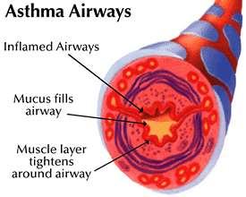 ASTHMA ATTACK SYMPTOMS: Cough, wheezing, trouble breathing, inability to speak.