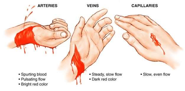 1. External Bleeding RED: REST ELEVATE DIRECT PRESSURE + Even & firm direct pressure (exception open fracture or penetrating object) with whatever