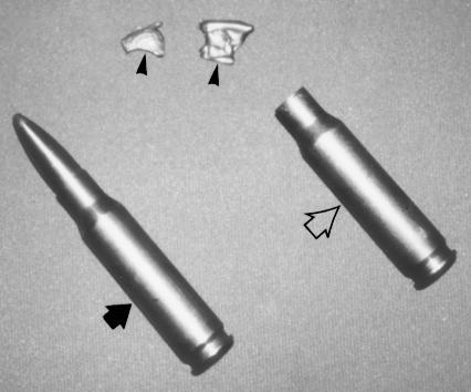 Figures 2, 3. (2) Radiograph of expeded bullets. The bullets were imaged o a step spoge at various distaces from the film.