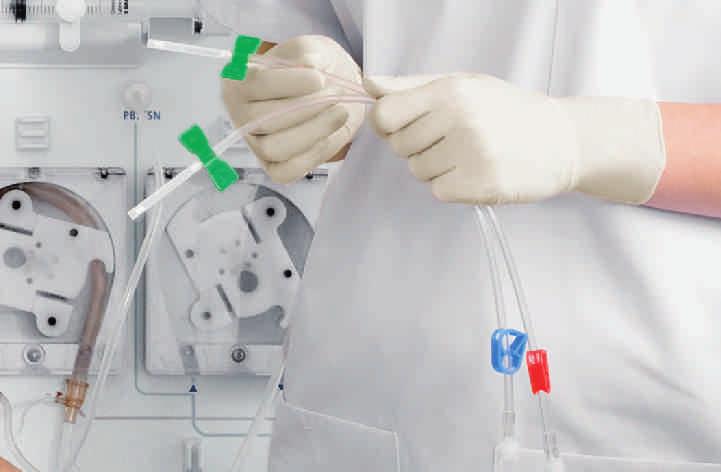 Using the optimum canulation procedure, the Diacan and Diacan S dialysis fistula needles from B. Braun cause, due to their precise 2-phase facet profile, minimal trauma to the vascular access.