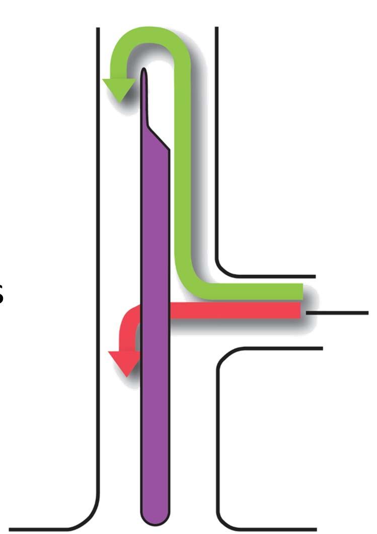 U Turns Safer than direct left turns Reduces the potential for