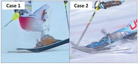 Slip catch situation But when the skier is out of balance, he or she may be unable to adjust to the rotary motion.