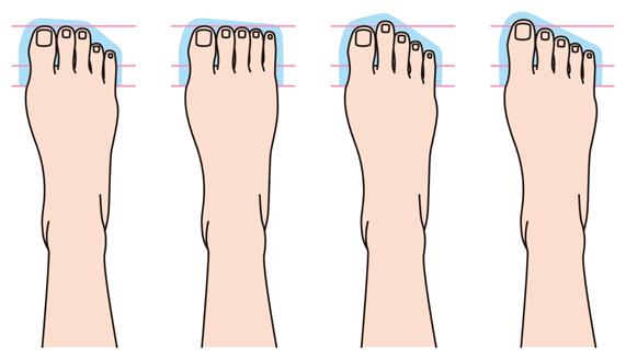 Now that you have a basic picture of your foot, does it make the Roman, Greek, or Egyptian shape?