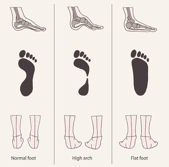 Are your feet skinny, normal or thick?
