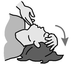 Gently and carefully turn the person on to her side. Push one arm under her body.