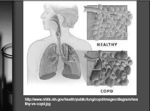 expand ú related to lung and chest wall elasticity and surface tension Conditions that decrease compliance Pulmonary fibrosis Pulmonary edema Respiratory distress syndrome 33 34