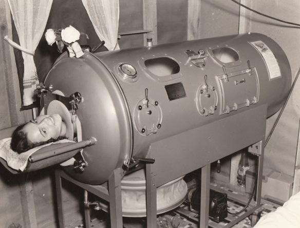 How a Mechanical Ventilator works The First Ventilator- the Iron Lung Worked by creating negative