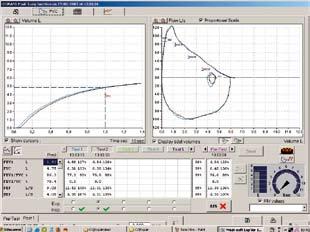 DLCO CH4 measurement by