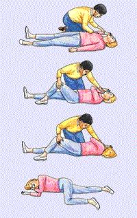 Recovery Position ABCDE Assessment