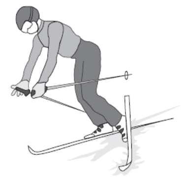 INTRODUCTION The most common type of fall among knee injured skiers seems a forward fall with body