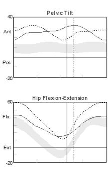 Anterior Pelvic Tilt Impairment reduced dissociation between pelvis and femur decreased hip sagittal plane ROM (solid) Secondary deviations