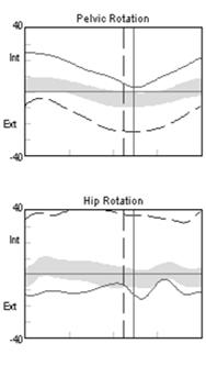 compensation increased ipsilateral external pelvis rotation (dashed) Secondary deviation increased contralateral internal pelvic rotation (solid) Multilevel Transverse
