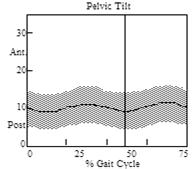 Pelvis Hip Motion Coronal (range of motion 8 degrees) Sagittal (range of motion 4 degrees) Transverse (range of motion 8 degrees) Hip