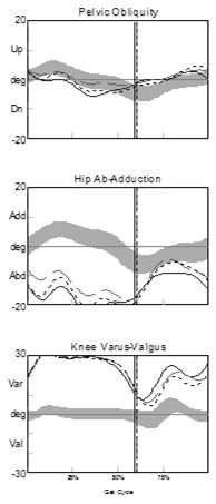 Left (dashed) Blount s - Knee Varus C89440 Knee Varus Sagittal Plane Terminology Impairment fixed knee varus deformity increased knee varus Secondary deviation hip