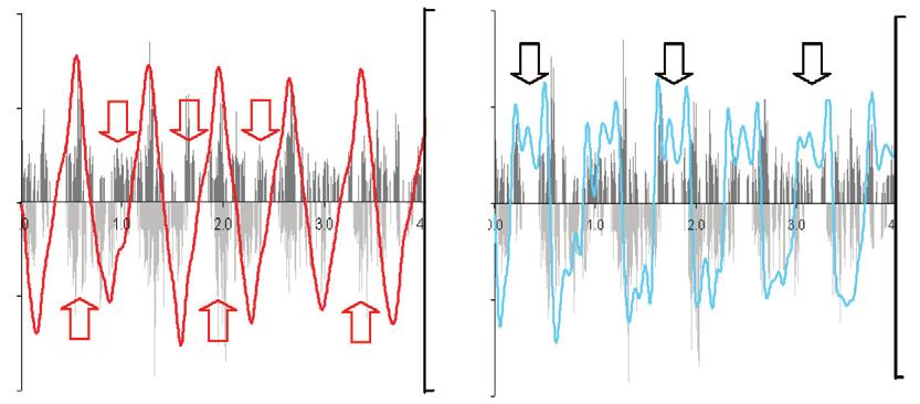 Representative angular velocity (red line) and angular acceleration (blue line) for the arm at the shoulder, overlaid on normalized anterior and posterior deltoid activity, during (A) walking at.